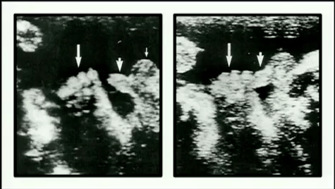 VÃ­deo: Pessoas mortas podem ter orgasmo e outros fatos sobre orgasmo